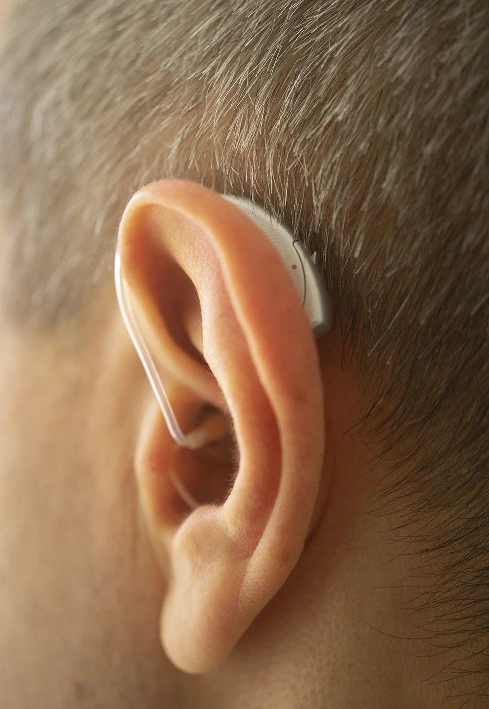 appareil auditif gros plan oreille, audioprothésiste marseille